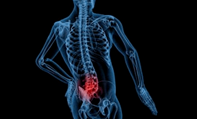 Az ágyéki osteochondrosis kialakulásának okai
