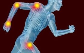 Az ízületi és arthrosis kialakulásának okai
