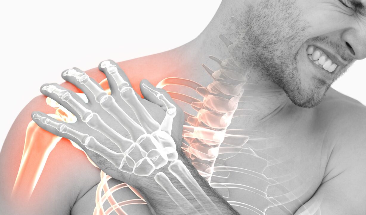 arthrosis okozta vállfájdalom